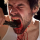 Image for article titled Proactive Man Removes Own Teeth In Attempt To Curb Nail-Biting Habit